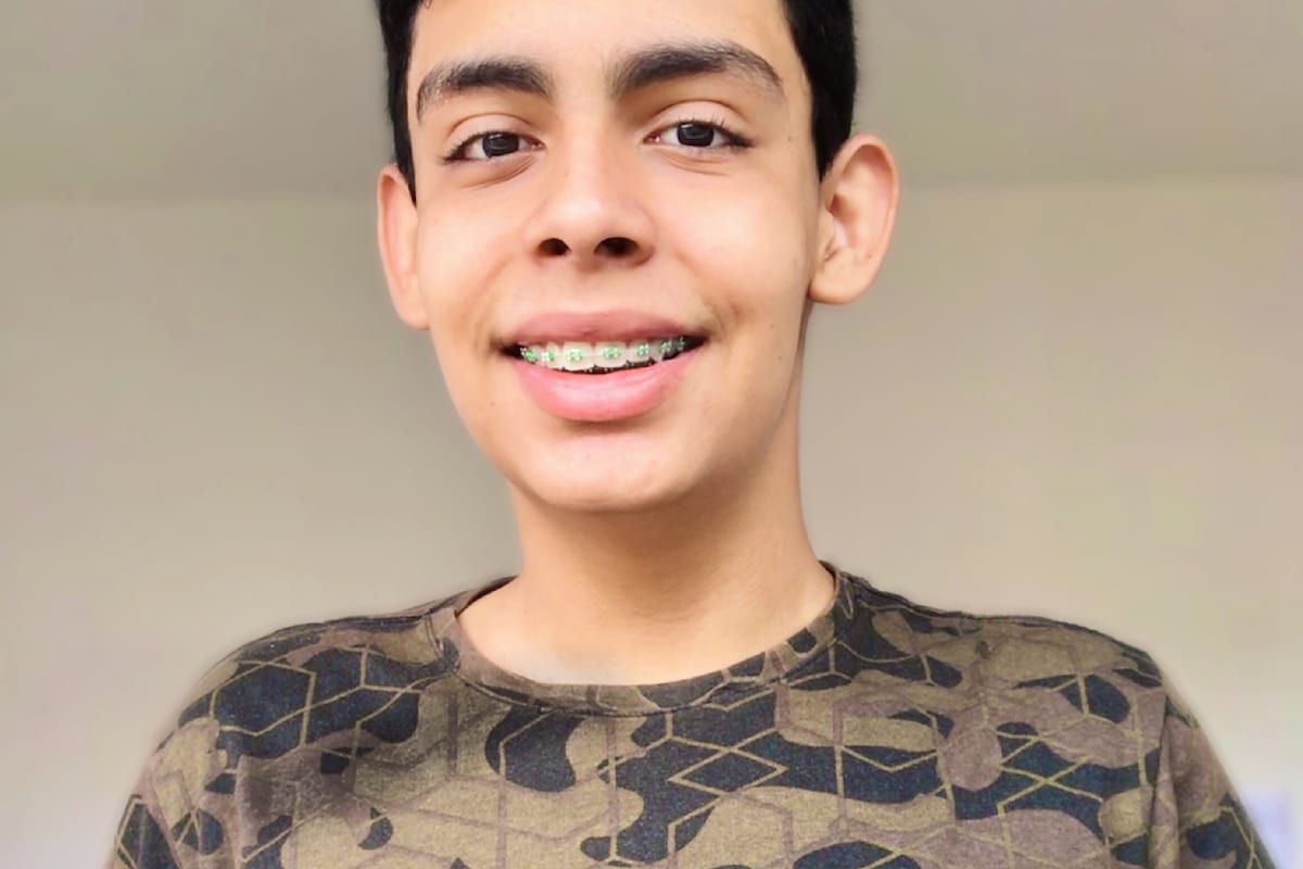 Braces (Metal)