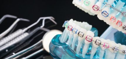 orthodontic-model-dentist-tool-demonstration-teeth-model-varities-orthodontic_60829-139-430x201